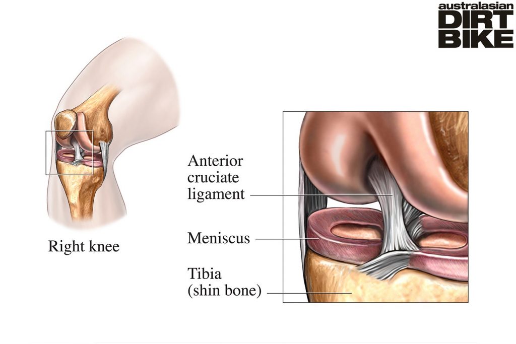 Knee injuries